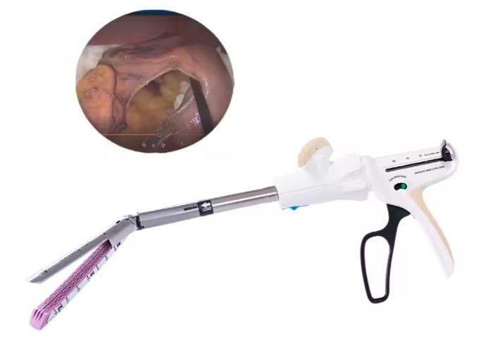 endoscopic linear cutter stapler